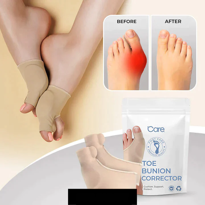 Tåskiller til hallux valgus og trykaflastning