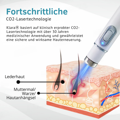 Laserpen til målrettet kosmetisk hudpleje