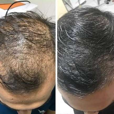 Hårshampoo med risekstrakt til skånsom hovedbundspleje